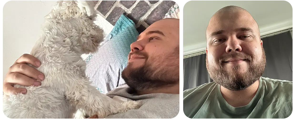 Роберт Каневський - збір на лікування