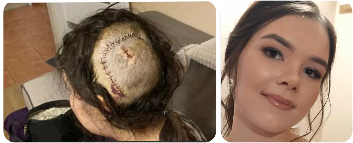 Katarzyna Podkowa - collecte de fonds pour le traitement