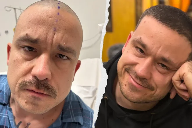 Piotr Wiśniewski - zbiorka na leczenie