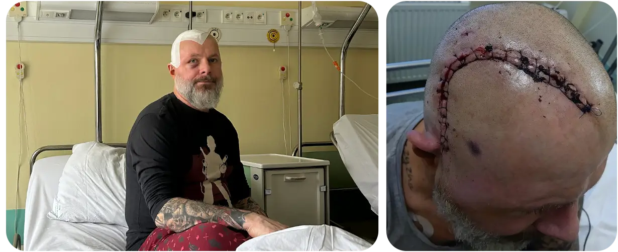 Paweł Płonczyński – Spendenaktion für die Behandlung