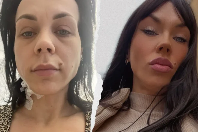 Marlena Piątek - zbiorka na leczenie