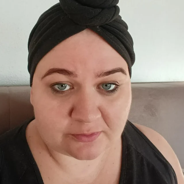 Monika Grzywna - zbiorka na leczenie